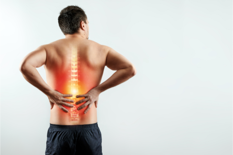 Scoliosis Treatment in McAllen
