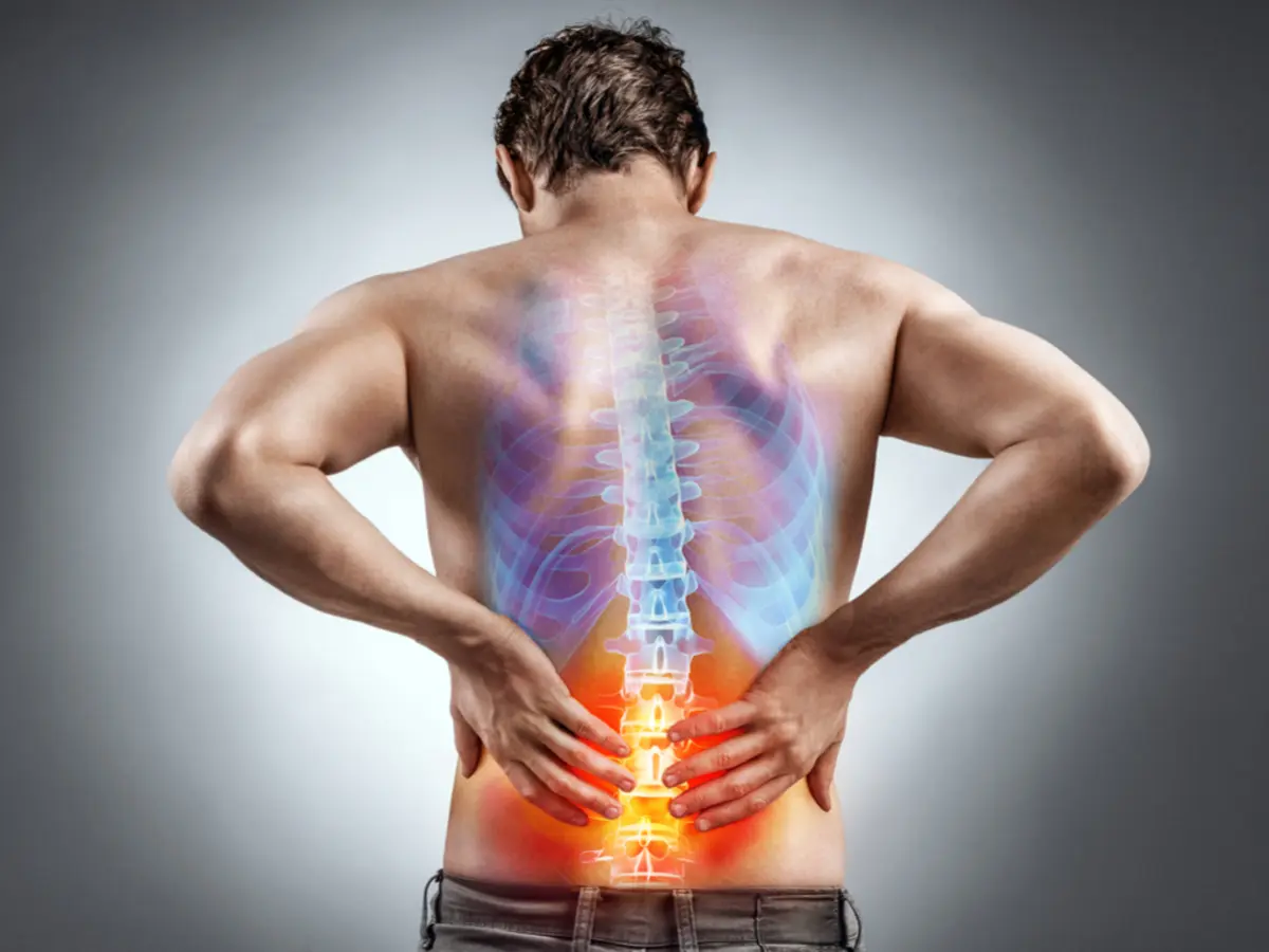 Herniated Disc Treatment in McAllen